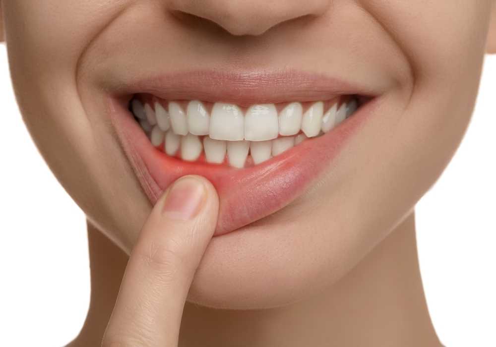 Ways to Prevent Gum Disease