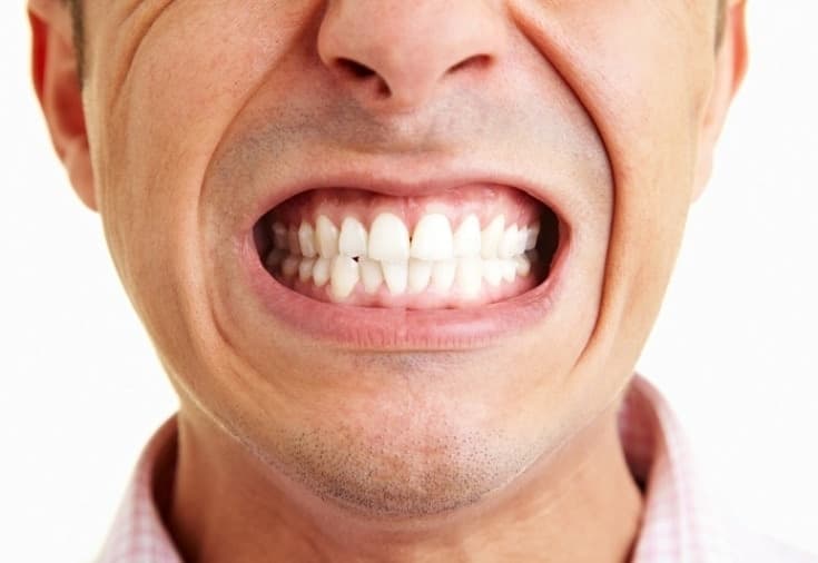 Do You Grind Your Teeth at Night? Bruxism Symptoms and Treatment